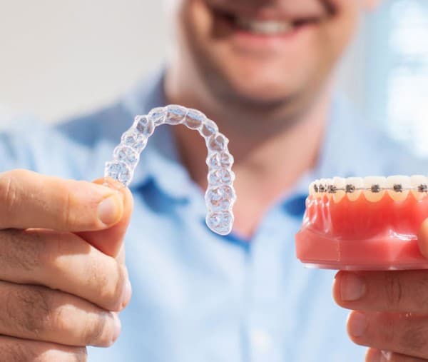 What are Invisible Aligners?