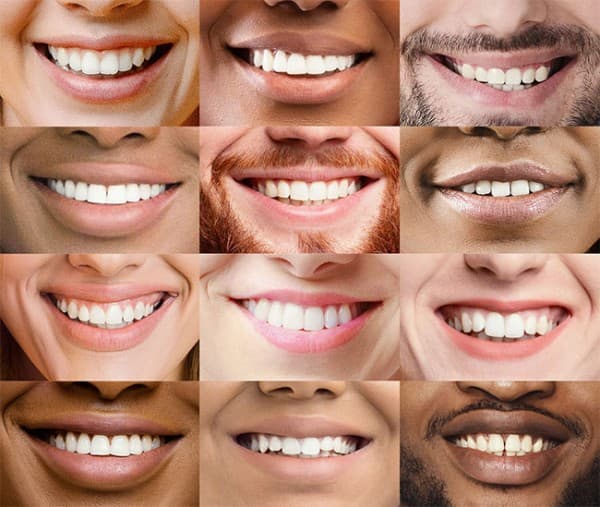 Zoom Whitening is here...